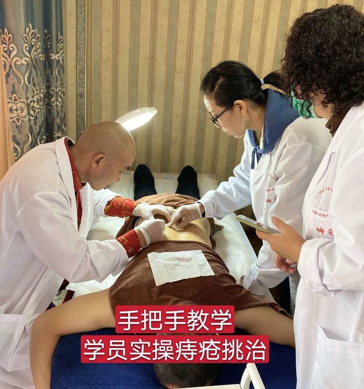 中医截根术(挑羊毛疔)培训过程