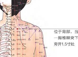 孩子发烧别着急输液吃药,中医介绍:按摩3个穴位可快速