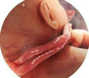 几个月开始胎儿容易脐带绕颈 ac07f0e1fae149eeb230098389380b64.jpeg