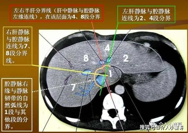 肝脏s8在哪里小崔哥为您讲解肝脏解剖位置