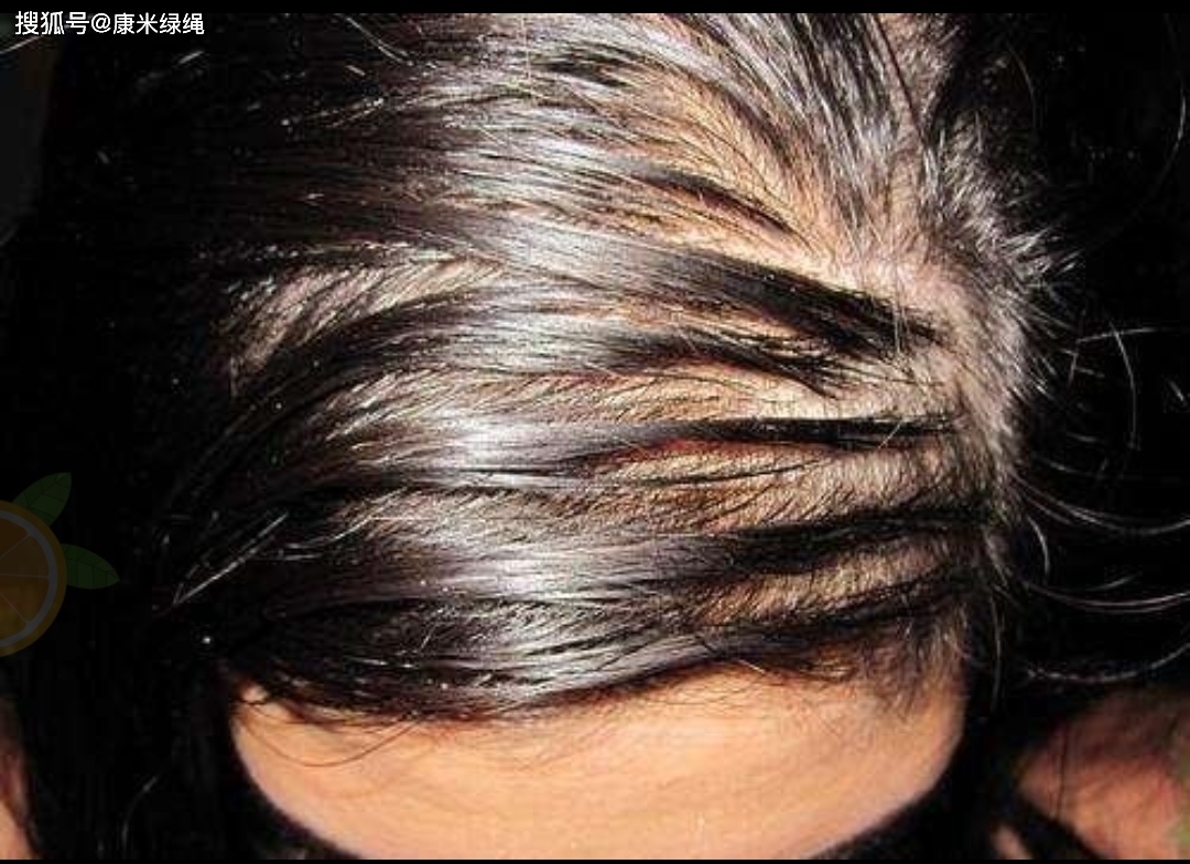 头发怎么长得浓密（想拥有乌黑浓密又柔顺亮泽的头发，这些方法就可以帮到你） | 说明书网