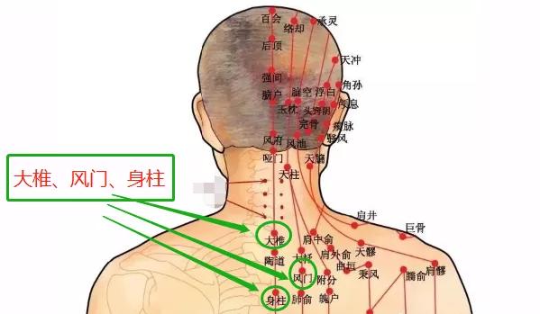 建议艾灸取穴:大椎,风门,身柱和命门.