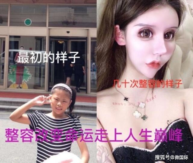 13岁女孩花100万整容60次整得面目全非网友：怪物？(图2)