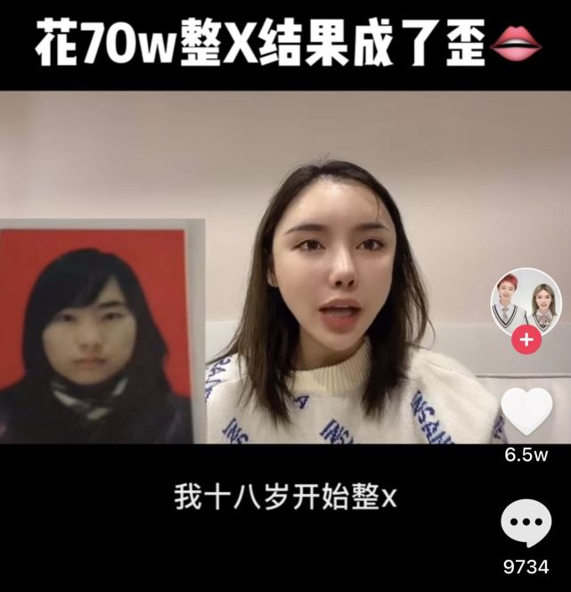 美女网红花70万却整形失败 磨骨伤到神经毁容 自叹非常后悔 木兰欧