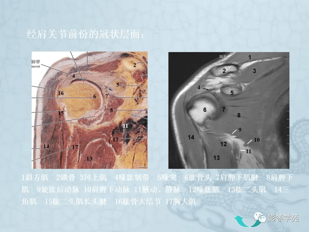 四肢断面解剖及影像