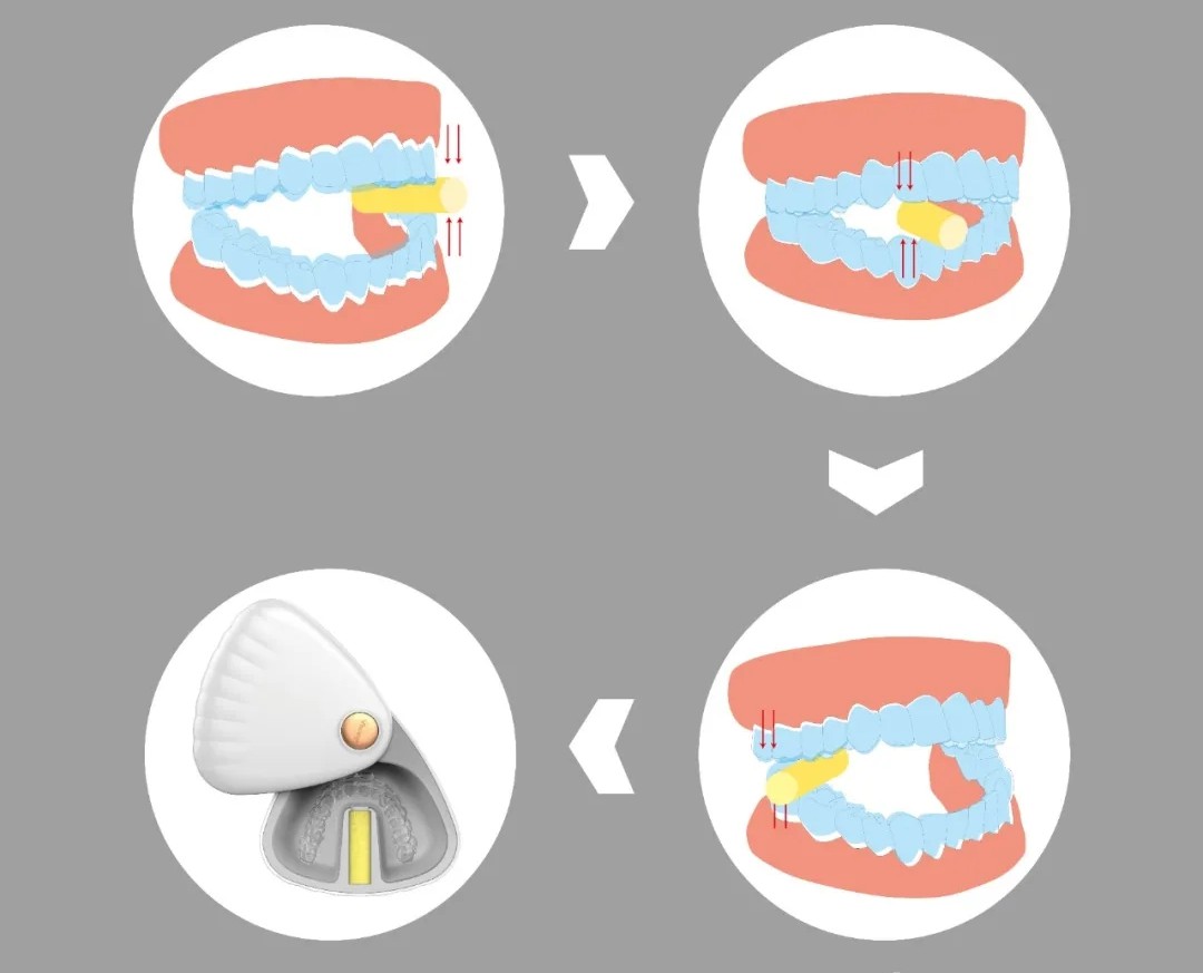 千万不要小看牙外伤：关于牙外伤对身体的影响 | 升艺口腔医院