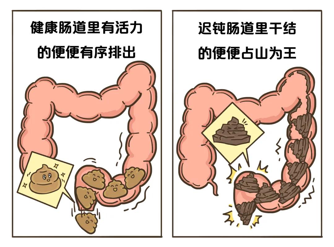 痔疮,肛门疼痛以及 肛裂的发生率上升,影响健康.