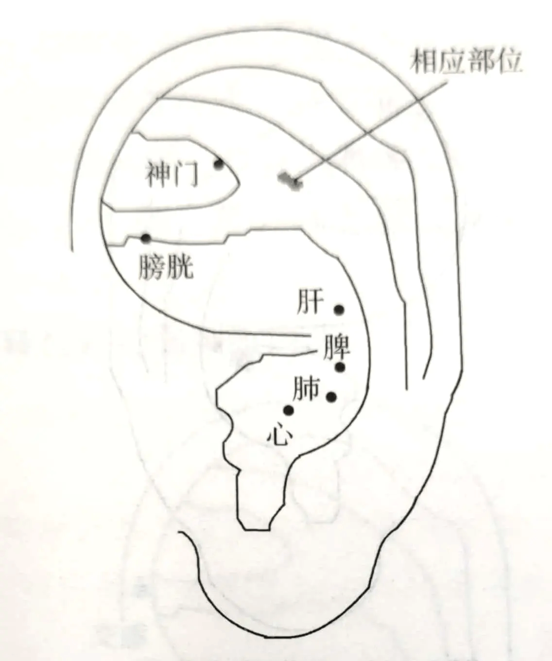 【治疗】取耳穴:相应部位,神门,心,肺,脾,肝,膀胱(如图)