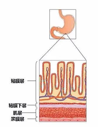 我们的胃壁分为四层,依次为: 粘膜层,粘膜下层,肌肉层,浆膜层.