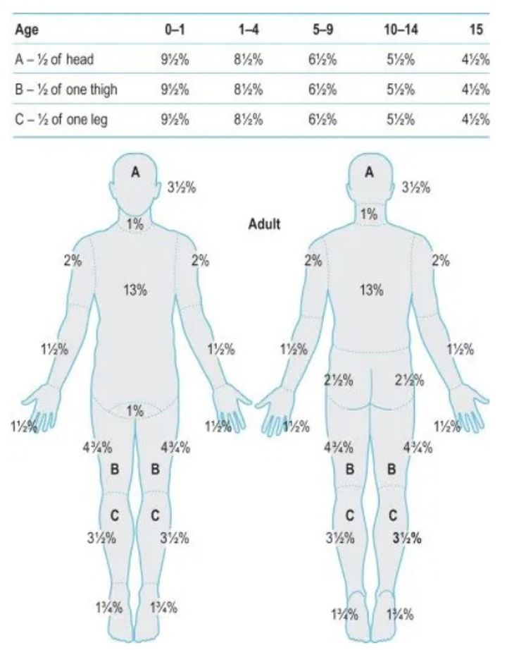 计算总体表面积百分比(tbsa)的方法,完全双侧足部烧伤最多7%tbsa(图4