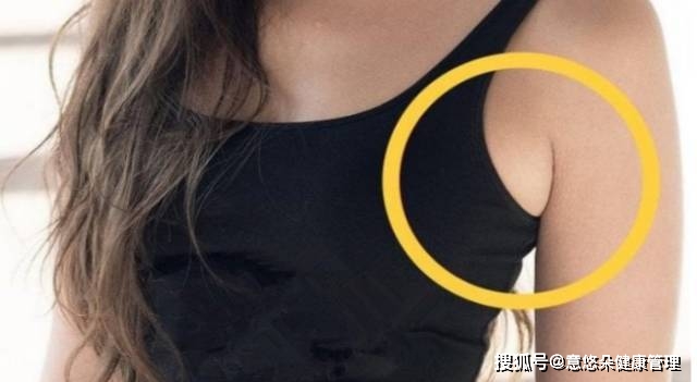 除了乳房自身的原因,副乳疼痛还有可能是因为淋巴结肿大.