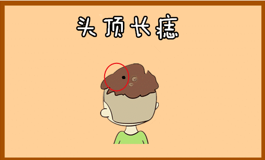 随着年龄的增长收入会越来越好的5颗富贵痣