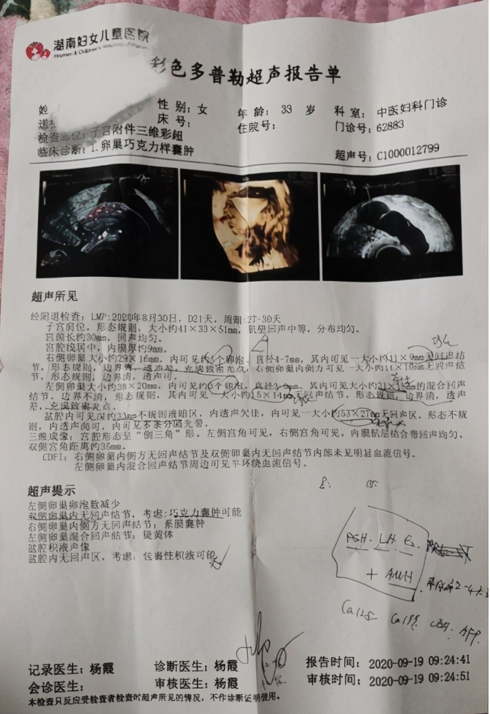 5年备孕无果因巧克力囊肿中医助力3个月不手术成功受孕