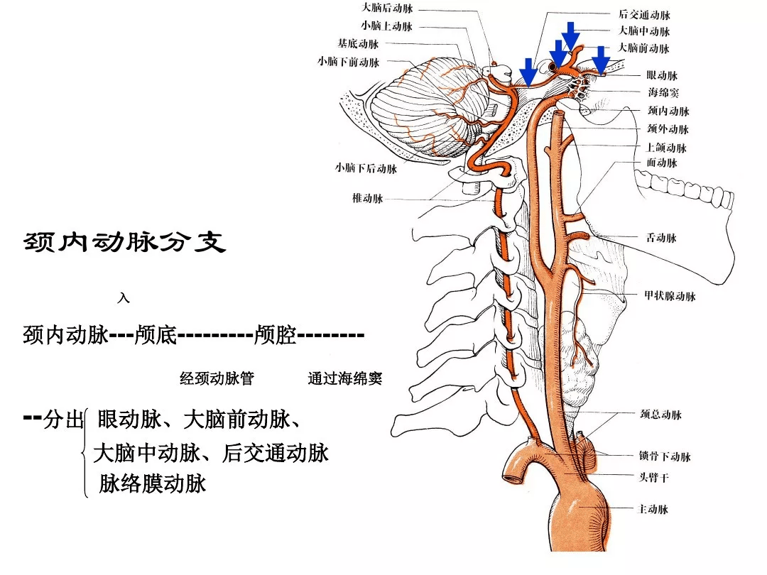 4:大脑动脉环(willis环)3:椎—基底动脉系统2:颈内动脉系统1:脑血管