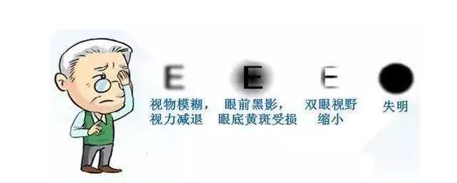 【居家自测】你有没有得白内障?