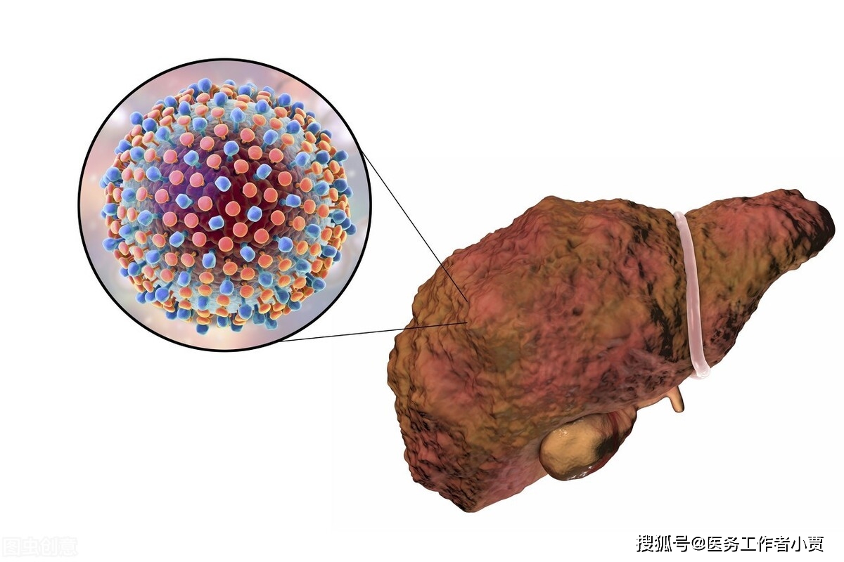 原创史上最全的肝癌小知识您想知道的全在这里