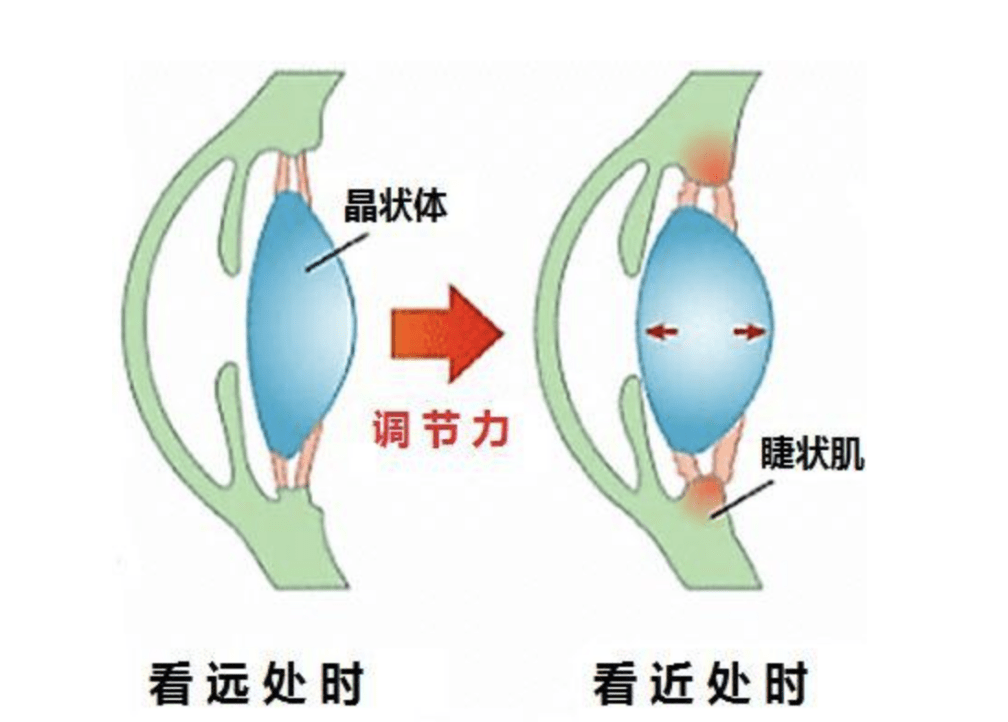 瞳视角课堂:"近距离用眼"是导致青少年近视的头号元凶