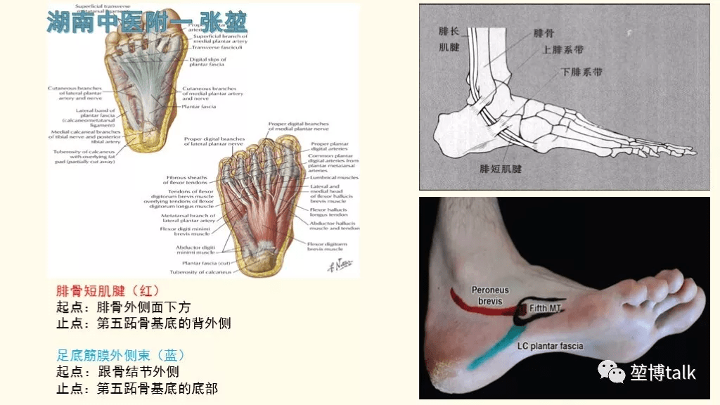 第五跖骨基底骨折——你真的懂吗?