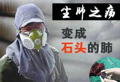 一般几年时间会有尘肺