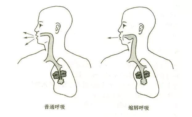 一爬楼就气喘?医生:你可能需要接受呼吸康复训练