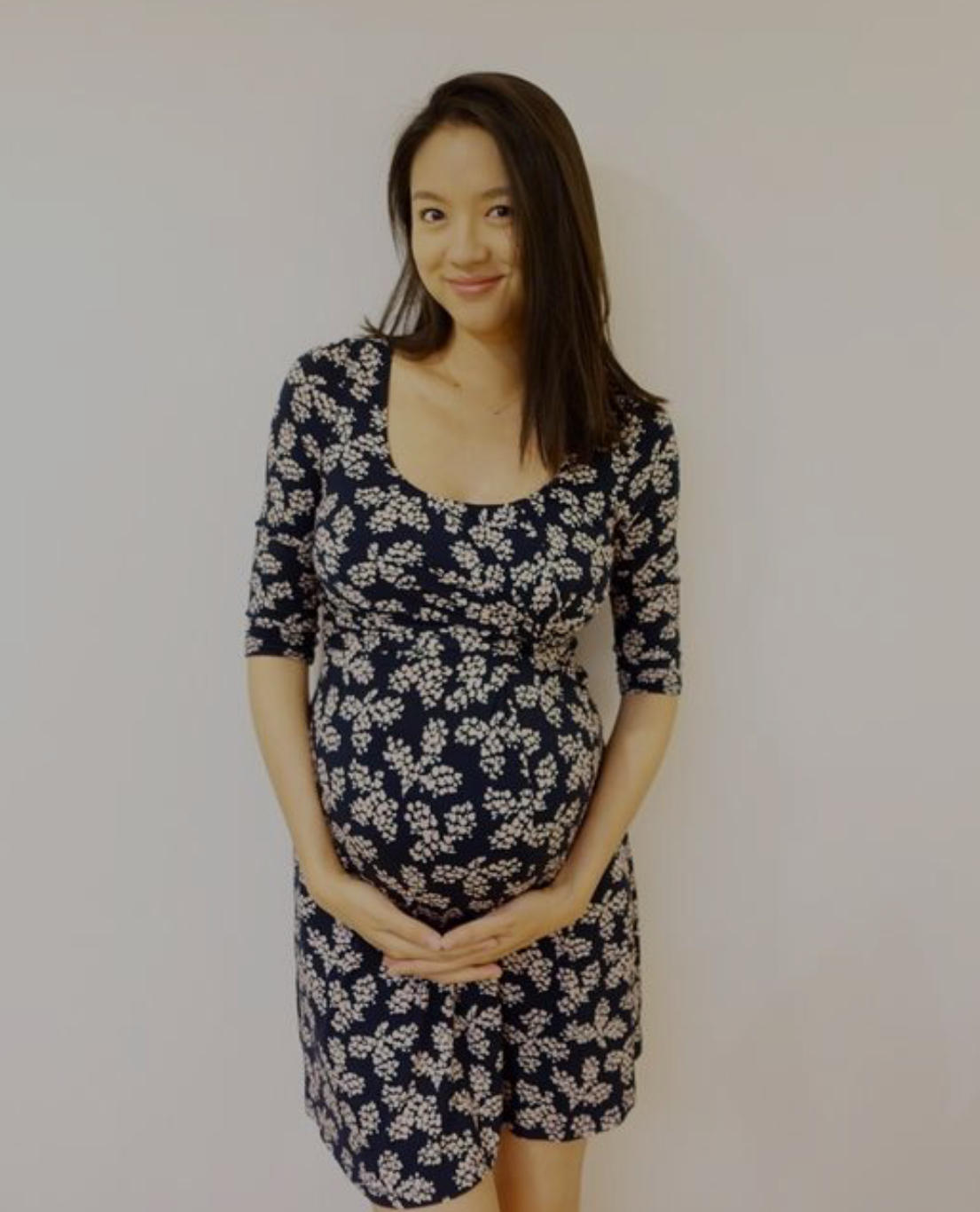 原创张梓琳素颜亮相,挺7月孕肚正面看不出怀孕,短裙下双腿依旧纤细