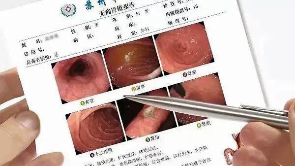 肠内癌变,大便先知?大便若有4种"异常",建议早做肠癌检查