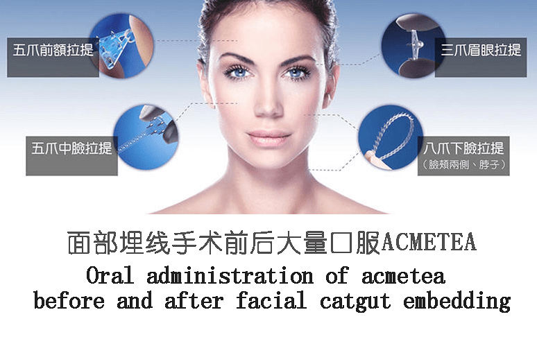 做一次线雕要多少钱acmetea提线盾吃多久提升效果新视点