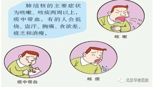 出现哪些症状,可能得了肺结核呢?