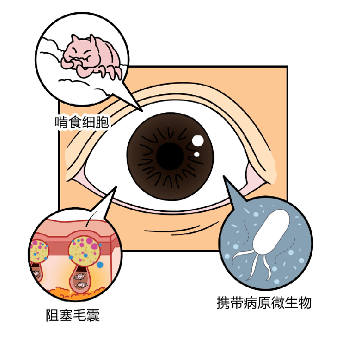 螨虫居然在眼睫毛上蠕动,很多人都有._眼睛