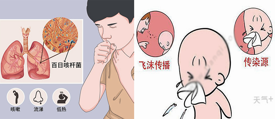【科普知识】"百日咳"的传播性有多强,你知道吗?