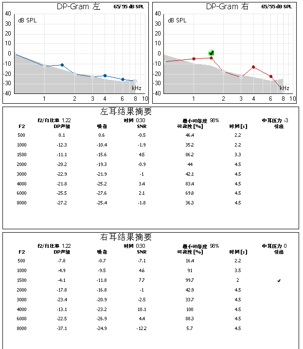 耳声发射左耳单峰as-430.24右耳双峰a-310.