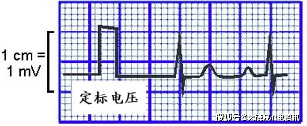 心电图机记录要点