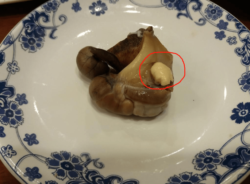 第三种:海螺的内脏囊不能吃