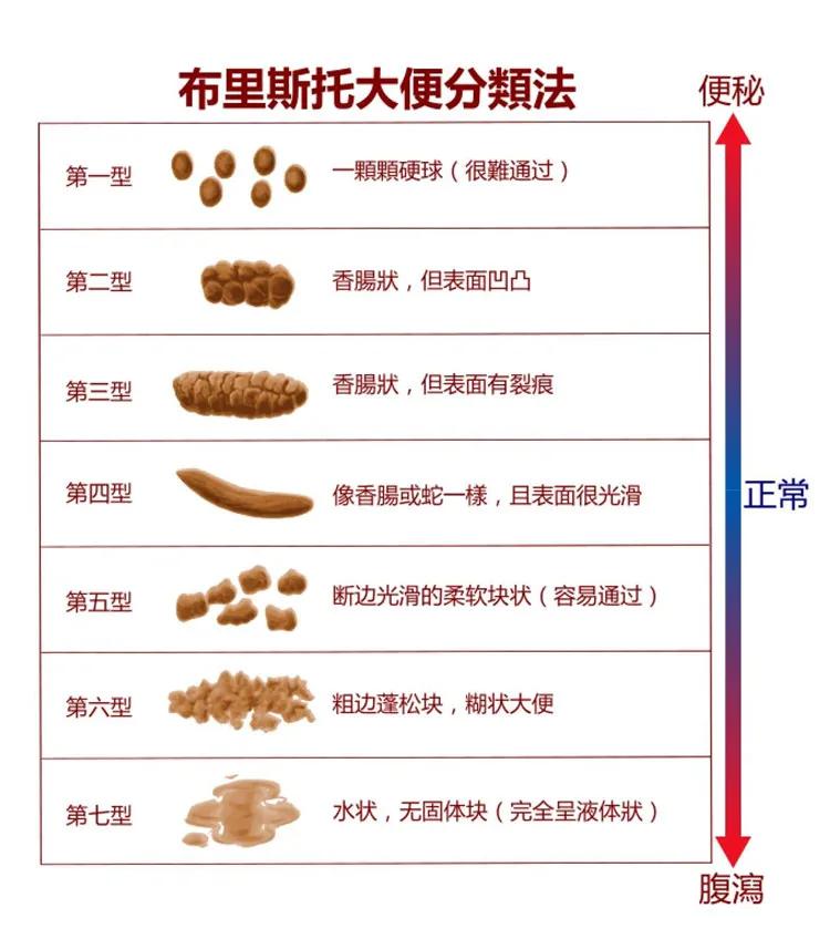 印小天曝父亲直肠癌晚期…医生:大便出现异常就要警惕,早期筛查很关键