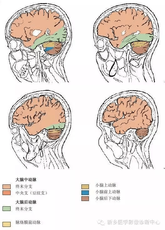 脑血管解剖图谱:详细标注 脑梗死责任血管判定