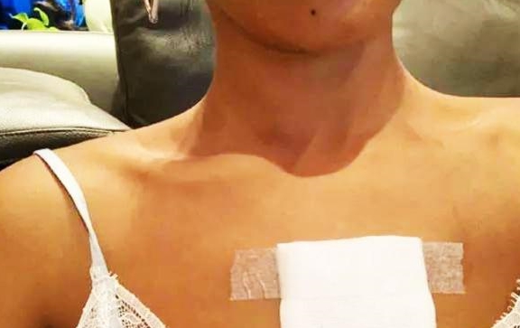 美女明星被爱宠弄伤一共打了8针网友看到宠物后常规操作