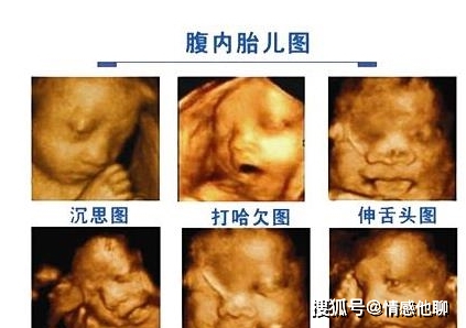 原创怀孕7个月是胎儿发育高峰期,4个关键指标不容忽视,孕妈要注意