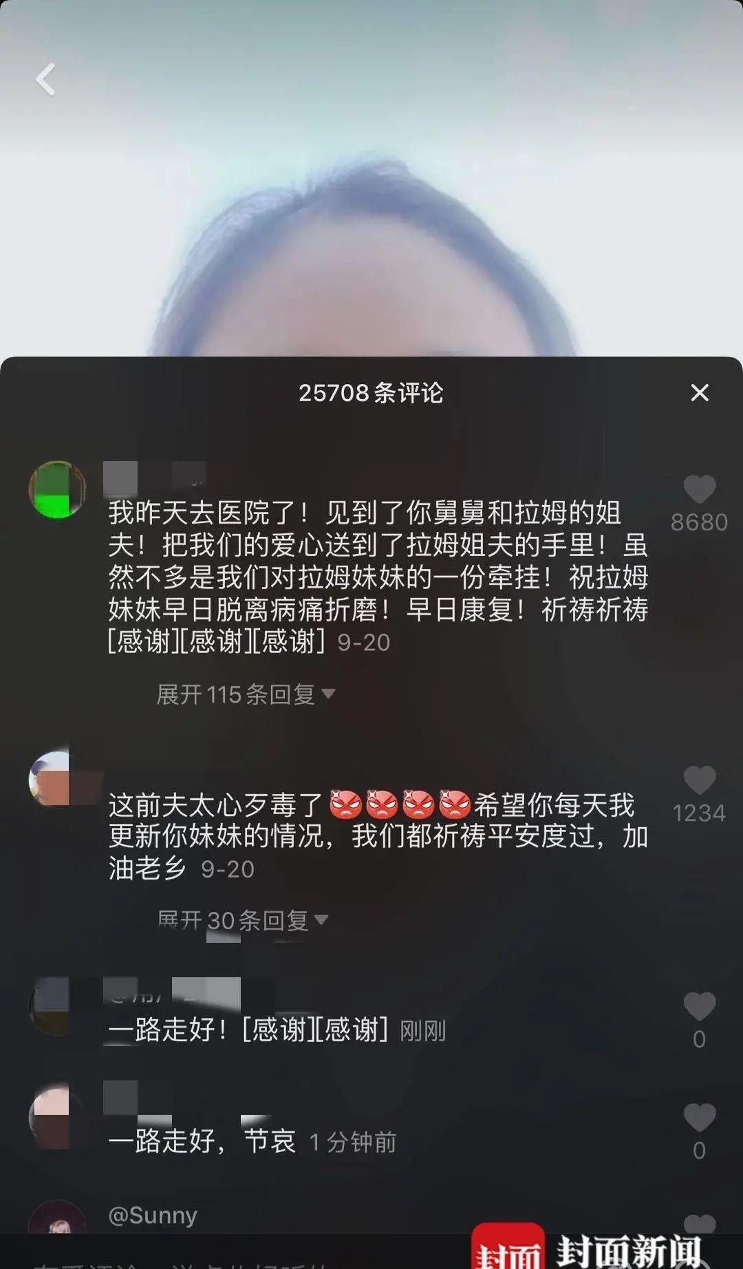 网红拉姆被前夫纵火烧伤去世姐姐称其长期遭家暴