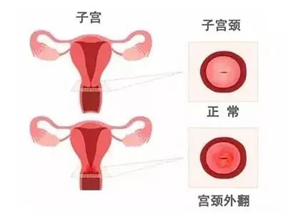 女性打过胎和没打过胎,医生一眼看穿,3个部位瞒不住