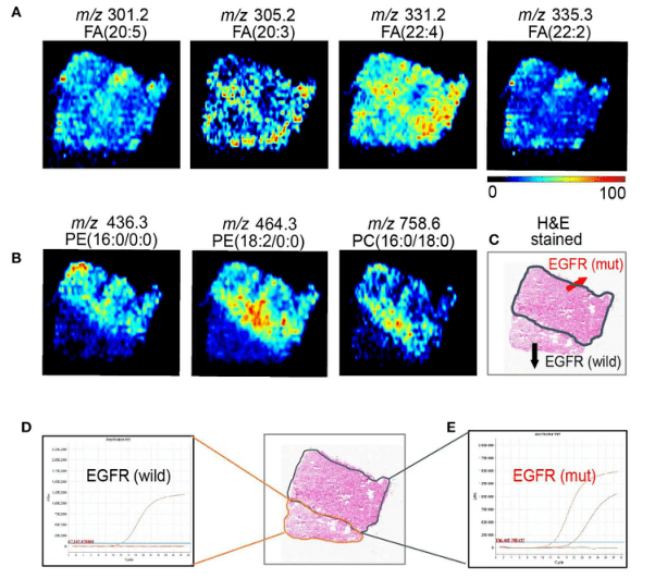 肿瘤学专区 定量质谱成像揭示非小细胞肺癌egfr突变的空间分布
