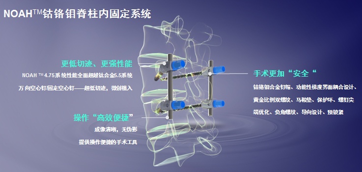 首套国产钴铬钼合金脊柱内固定系统启用
