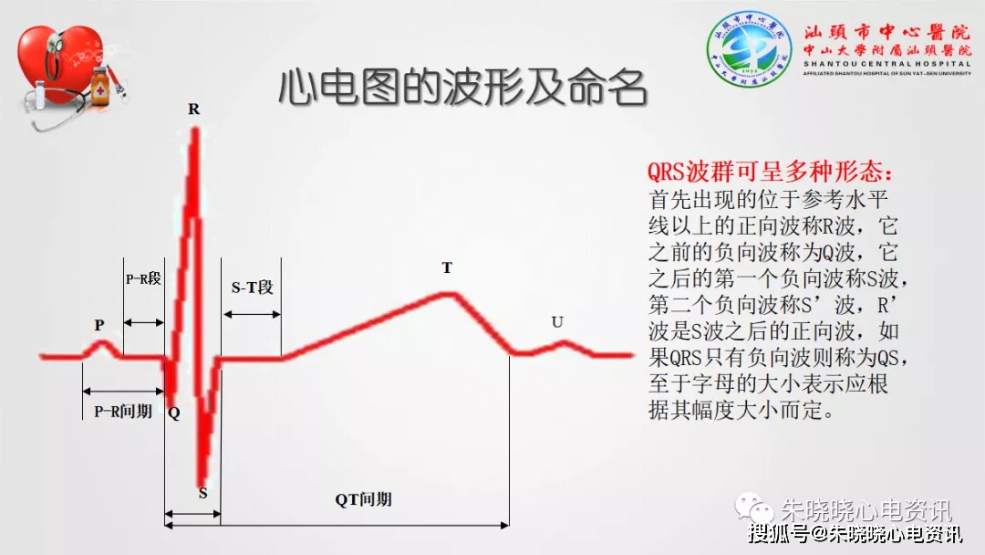 心电图要点知识汇总(ppt)