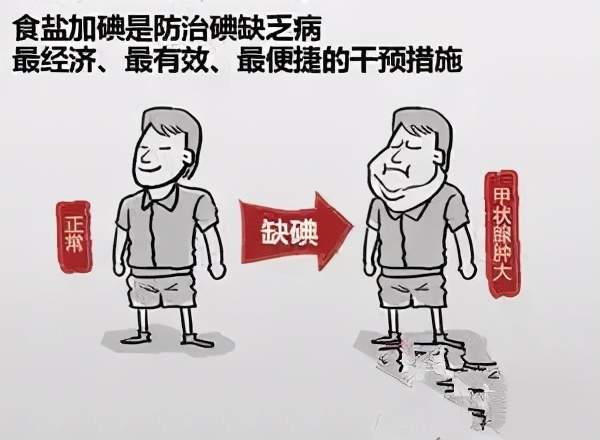 持续科学补碘 共享健康人生