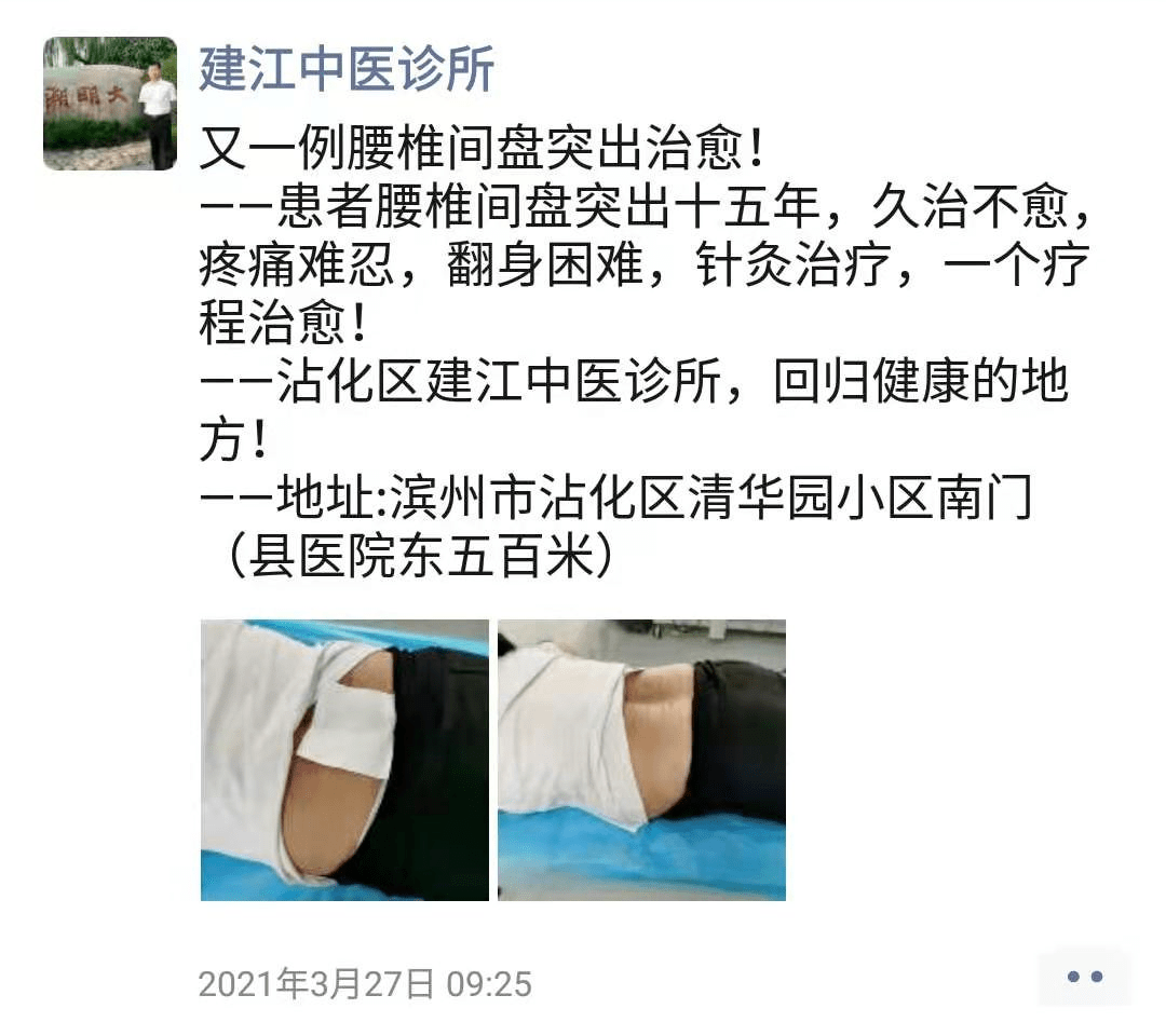 腰间盘突出患者,针灸治愈