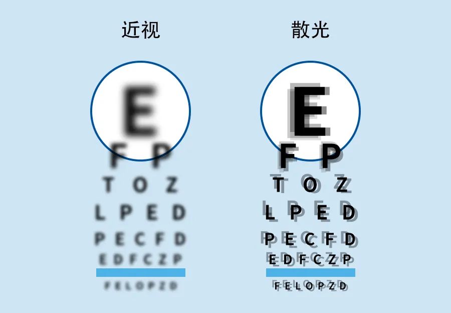 维适眼科王军主任:近视,散光,到底是谁影响了孩子的视力?