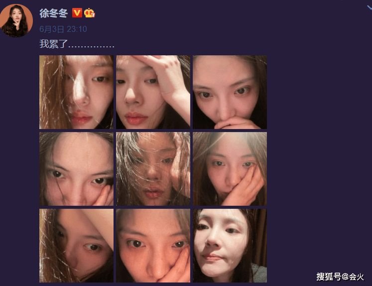 徐冬冬深夜晒素颜"哭照"!皮肤洁白看不到毛孔,脸上鼻涕太明显