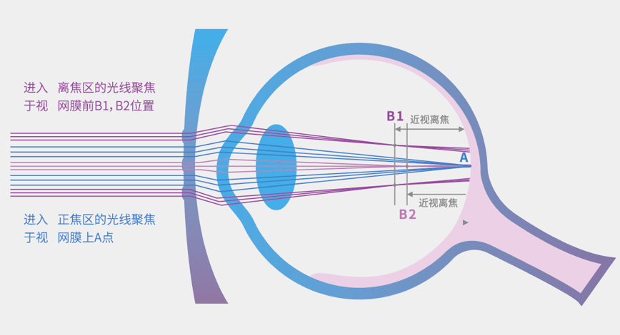 佩戴近视防控眼镜