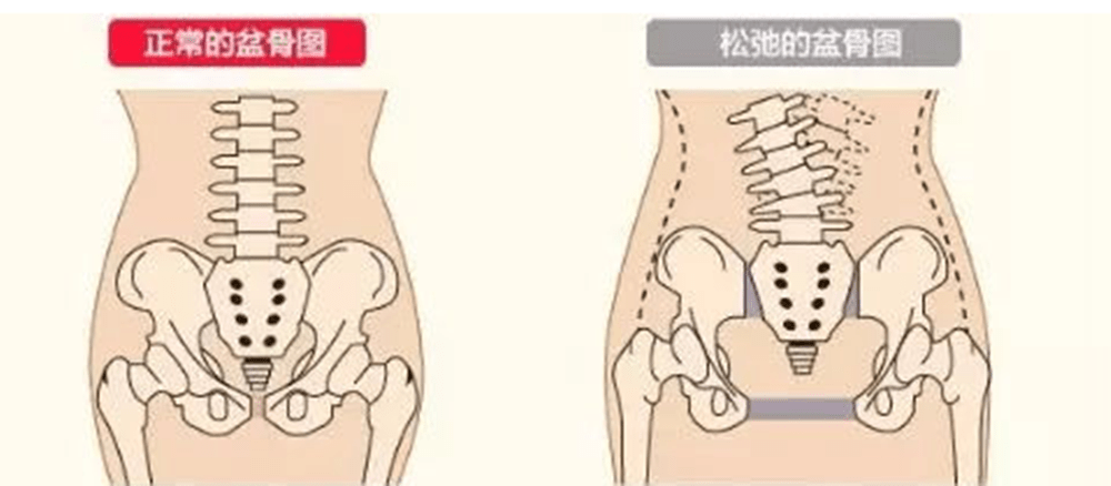 选择剖宫产就会避免产道松弛？别傻了！有＂生＂就会有＂松＂