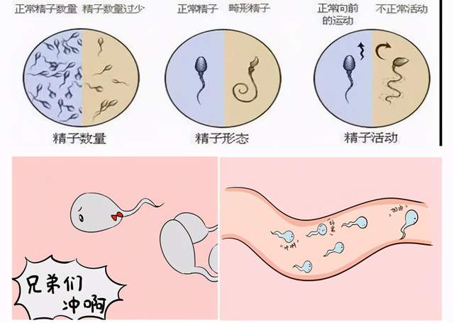 科普小知识:教你如何读懂精液常规分析报告