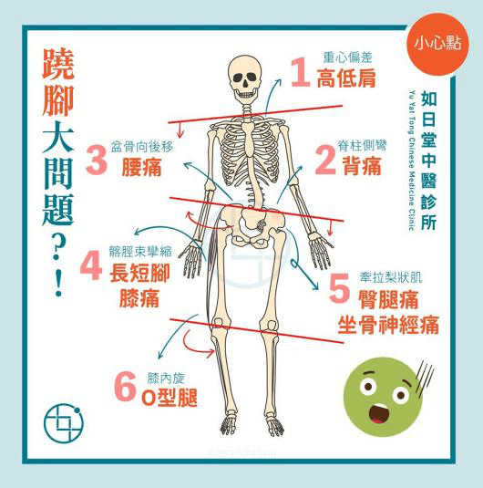 近年我国儿童青少年脊柱侧弯发病率逐年升高